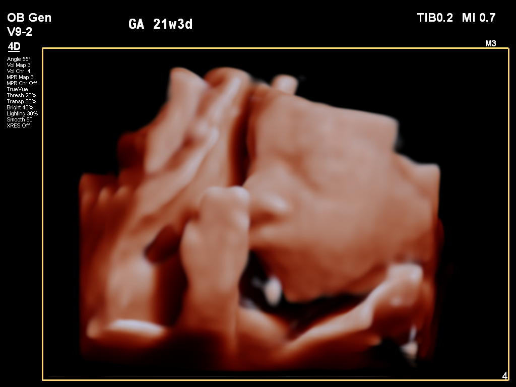 4D ultrasound at 21 weeks 3 days